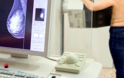 Imatge d'una dona fent-se una mamografia | Arxiu