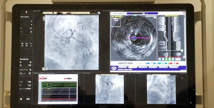 Imatge d'una diagnosi feta a la nova sala d'Hemodinàmica/ Taulí