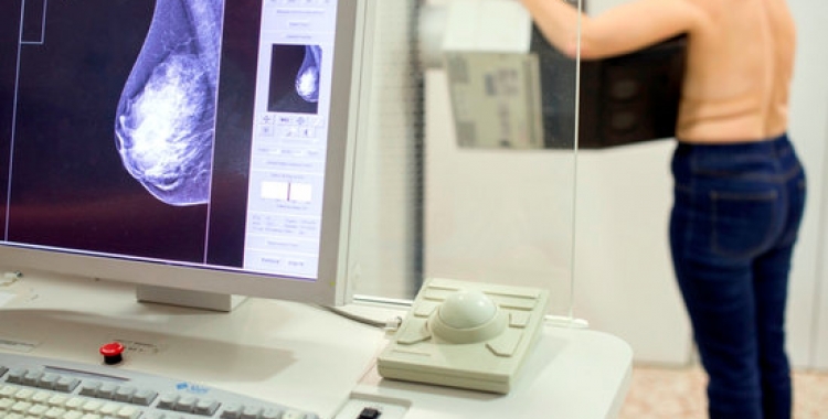 Una pacient fent-se una mamografia/ ACN
