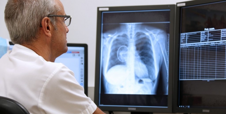 El Parc Taulí ultima un sistema automàtic de detecció de possibles càncers pulmonars | Cedida