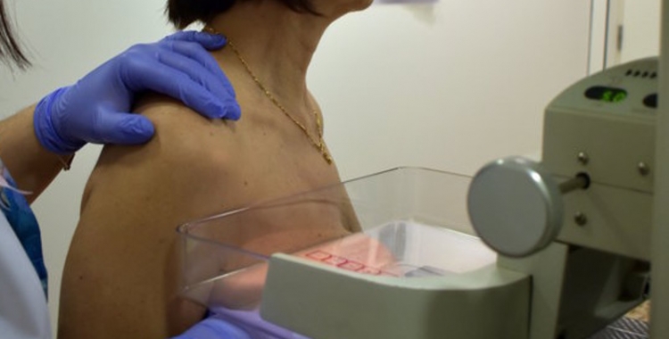 Una dona fent-se una mamografia/ ACN