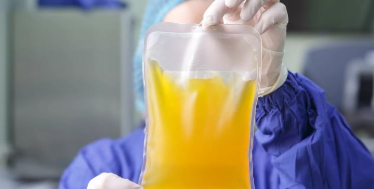 Una bossa de plasma extreta d'un pacient | Pexels