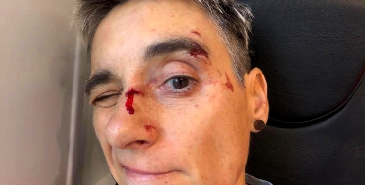 La ciclista sabadellenca s'ha endut el cop principalment a la cara