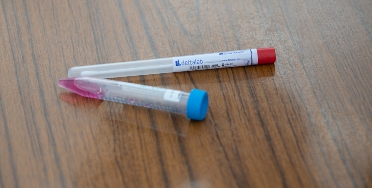 Imatge de les mostres recollides en una PCR | Roger Benet