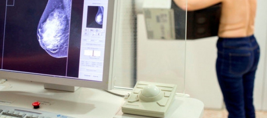 Una dona fent-se una mamografia | Arxiu (ACN)