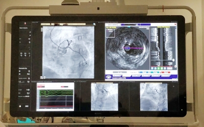 Imatge d'una diagnosi feta a la nova sala d'Hemodinàmica/ Taulí