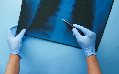 Un professional sanitari amb una radiografia/ Cedida