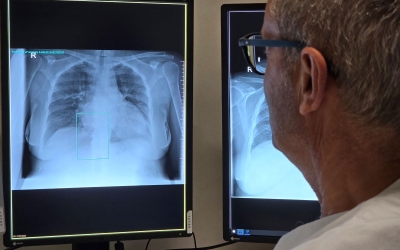Sanitari observant una radiografia 