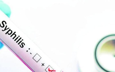 Imatge d'un test de sífilis | Cedida