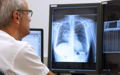 Avui, es commemora el Dia Mundial Contra el Càncer