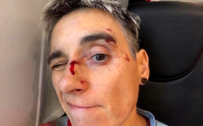 La ciclista sabadellenca s'ha endut el cop principalment a la cara