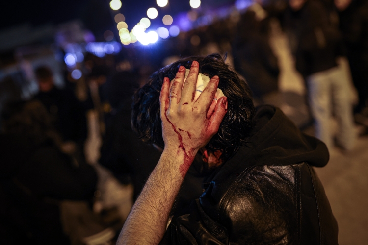 Persona ferida per les càrregues policials