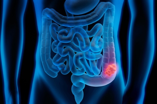 flora intestinal